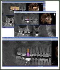 3-D CT Imaging